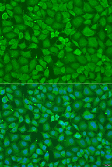 Immunofluorescence - TRH Polyclonal Antibody 