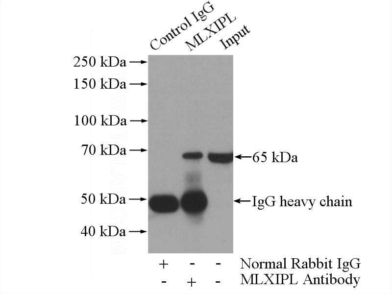 IP Result of anti-MLXIPL (IP:Catalog No:112688, 4ug; Detection:Catalog No:112688 1:1000) with HepG2 cells lysate 3600ug.