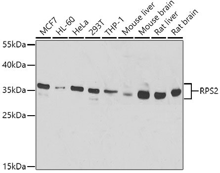 Western blot - RPS2 Polyclonal Antibody 