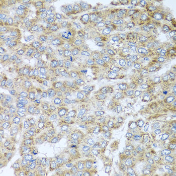 Immunohistochemistry - NDUFA2 Polyclonal Antibody 