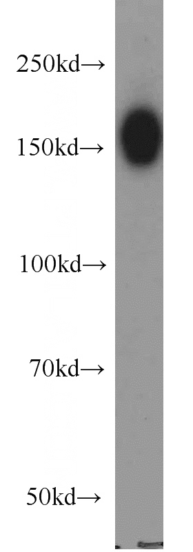 HeLa cells were subjected to SDS PAGE followed by western blot with Catalog No:109979(DISP1 antibody) at dilution of 1:500