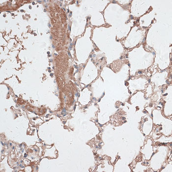 Immunohistochemistry - JMJD7 Polyclonal Antibody 