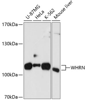 Western blot - WHRN Polyclonal Antibody 