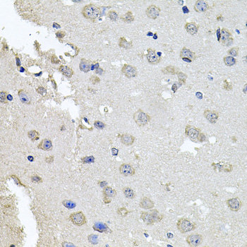 Immunohistochemistry - PKN1 Polyclonal Antibody 