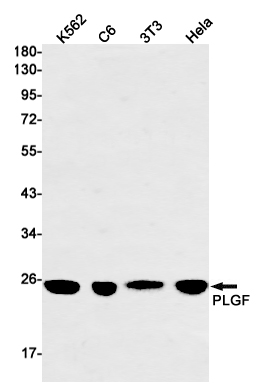 Western blot detection of PLGF in K562,C6,3T3,Hela cell lysates using PLGF Rabbit mAb(1:1000 diluted).Predicted band size:25kDa.Observed band size:25kDa.