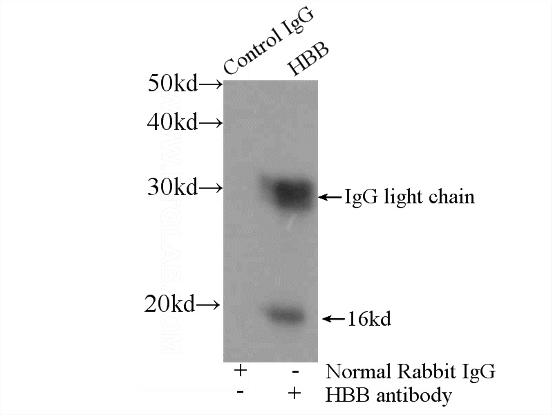 IP Result of anti-HBB (IP:Catalog No:111266, 4ug; Detection:Catalog No:111266 1:1000) with mouse heart tissue lysate 3200ug.