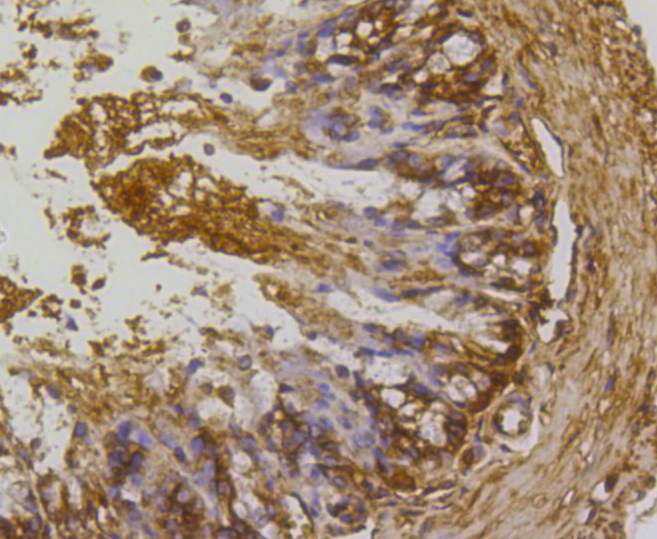 Immunohistochemistry - RHOA/RHOB/RHOC Monoclonal Antibody 