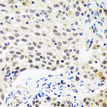 Immunohistochemistry - Myogenin Polyclonal Antibody 