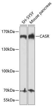 Western blot - CASR Polyclonal Antibody 