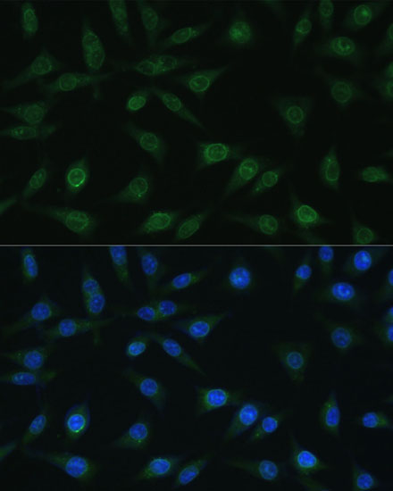 Immunofluorescence - NUP98 Polyclonal Antibody 