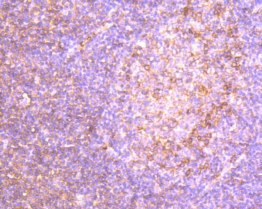 Fig2:; Immunohistochemical analysis of paraffin-embedded human tonsil tissue using anti-Human IgM antibody. Counter stained with hematoxylin.