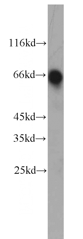 mouse brain tissue were subjected to SDS PAGE followed by western blot with Catalog No:107820(ABLIM2 antibody) at dilution of 1:1000