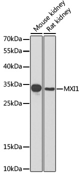 Western blot - MXI1 Polyclonal Antibody 