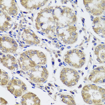 Immunohistochemistry - CTSC Polyclonal Antibody 
