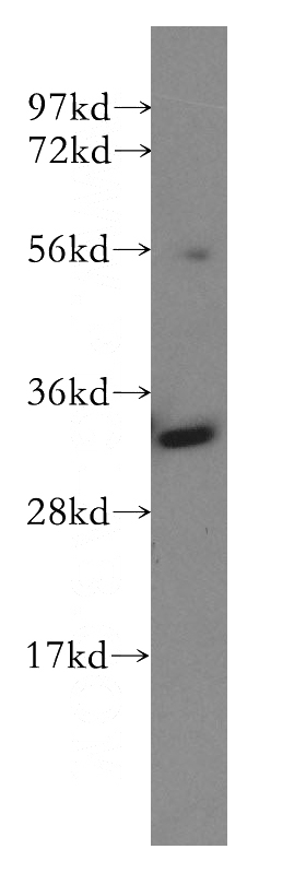 K-562 cells were subjected to SDS PAGE followed by western blot with Catalog No:111008(GNPDA1 antibody) at dilution of 1:400