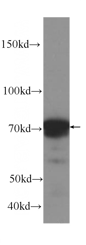 human heart tissue were subjected to SDS PAGE followed by western blot with Catalog No:107346(OPTN Antibody) at dilution of 1:1000