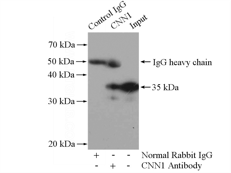IP Result of anti-Calponin (IP:Catalog No:108905, 4ug; Detection:Catalog No:108905 1:1000) with mouse lung tissue lysate 2800ug.
