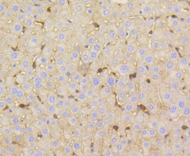 Fig8:; Immunohistochemical analysis of paraffin-embedded mouse liver tissue using anti-Vitronectin antibody. The section was pre-treated using heat mediated antigen retrieval with Tris-EDTA buffer (pH 8.0-8.4) for 20 minutes.The tissues were blocked in 5% BSA for 30 minutes at room temperature, washed with ddH; 2; O and PBS, and then probed with the primary antibody ( 1/50) for 30 minutes at room temperature. The detection was performed using an HRP conjugated compact polymer system. DAB was used as the chromogen. Tissues were counterstained with hematoxylin and mounted with DPX.