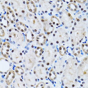 Immunohistochemistry - CCAR2 Polyclonal Antibody 