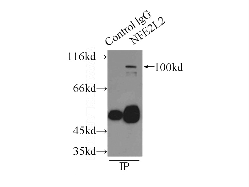 IP Result of anti-NRF2, NFE2L2 (IP:Catalog No:113277, 3ug; Detection:Catalog No:113277 1:300) with mouse kidney tissue lysate 4000ug.