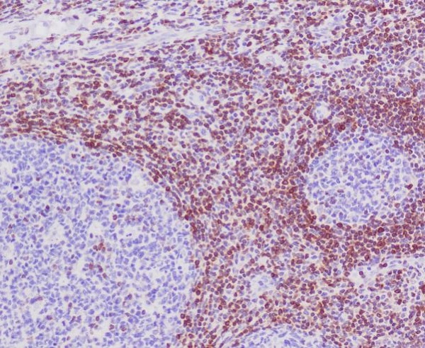 Immunohistochemical analysis of paraffin-embedded human tonsil, using Bcl-2 Antibody.
