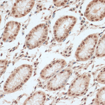 Immunohistochemistry - ZNF574 Polyclonal Antibody 