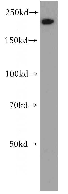 COLO 320 cells were subjected to SDS PAGE followed by western blot with Catalog No:112931(MYH14 antibody) at dilution of 1:800