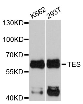 Western blot - TES Polyclonal Antibody 