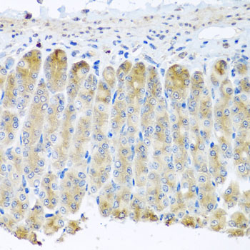 Immunohistochemistry - TAMM41 Polyclonal Antibody 