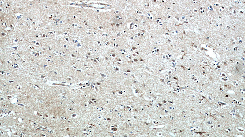 Immunohistochemical of paraffin-embedded human brain using Catalog No:113972(PLK5P antibody) at dilution of 1:50 (under 10x lens)