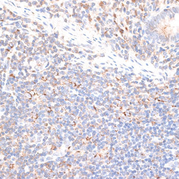 Immunohistochemistry - KIF14 Polyclonal Antibody 