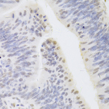 Immunohistochemistry - HDGF Polyclonal Antibody 
