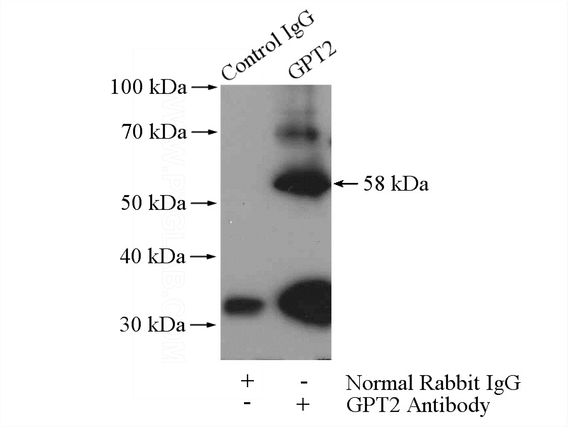 IP Result of anti-GPT2 (IP:Catalog No:111147, 4ug; Detection:Catalog No:111147 1:500) with mouse kidney tissue lysate 7200ug.