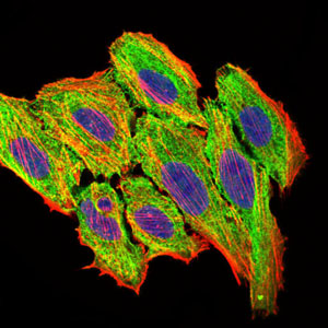 Fig3: ICC staining CCL2 (green) and actin filaments (red) in HepG2 cells. The nuclear counter stain is DAPI (blue). Cells were fixed in paraformaldehyde, permeabilised with 0.25% Triton X100/PBS.
