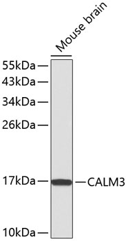 Western blot - CALM3 Polyclonal Antibody 