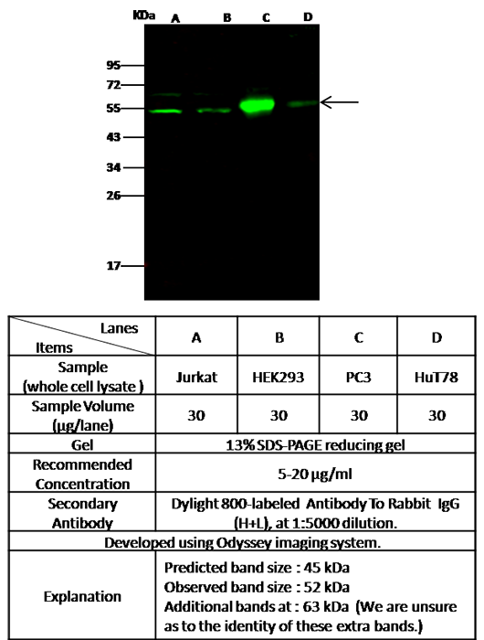 IL11RA / IL-11RA Antibody, Rabbit PAb, Antigen Affinity Purified, Western blot