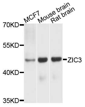 Western blot - ZIC3 Polyclonal Antibody 