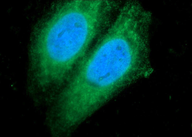 Immunofluorescent analysis of HepG2 cells using Catalog No:111837(IRF5 Antibody) at dilution of 1:25 and Alexa Fluor 488-congugated AffiniPure Goat Anti-Rabbit IgG(H+L)