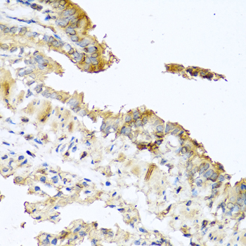 Immunohistochemistry - RNASE11 Polyclonal Antibody 