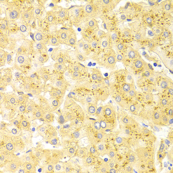 Immunohistochemistry - WT1 Polyclonal Antibody 