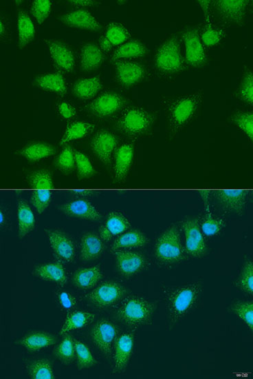 Immunofluorescence - EYA3 Polyclonal Antibody 