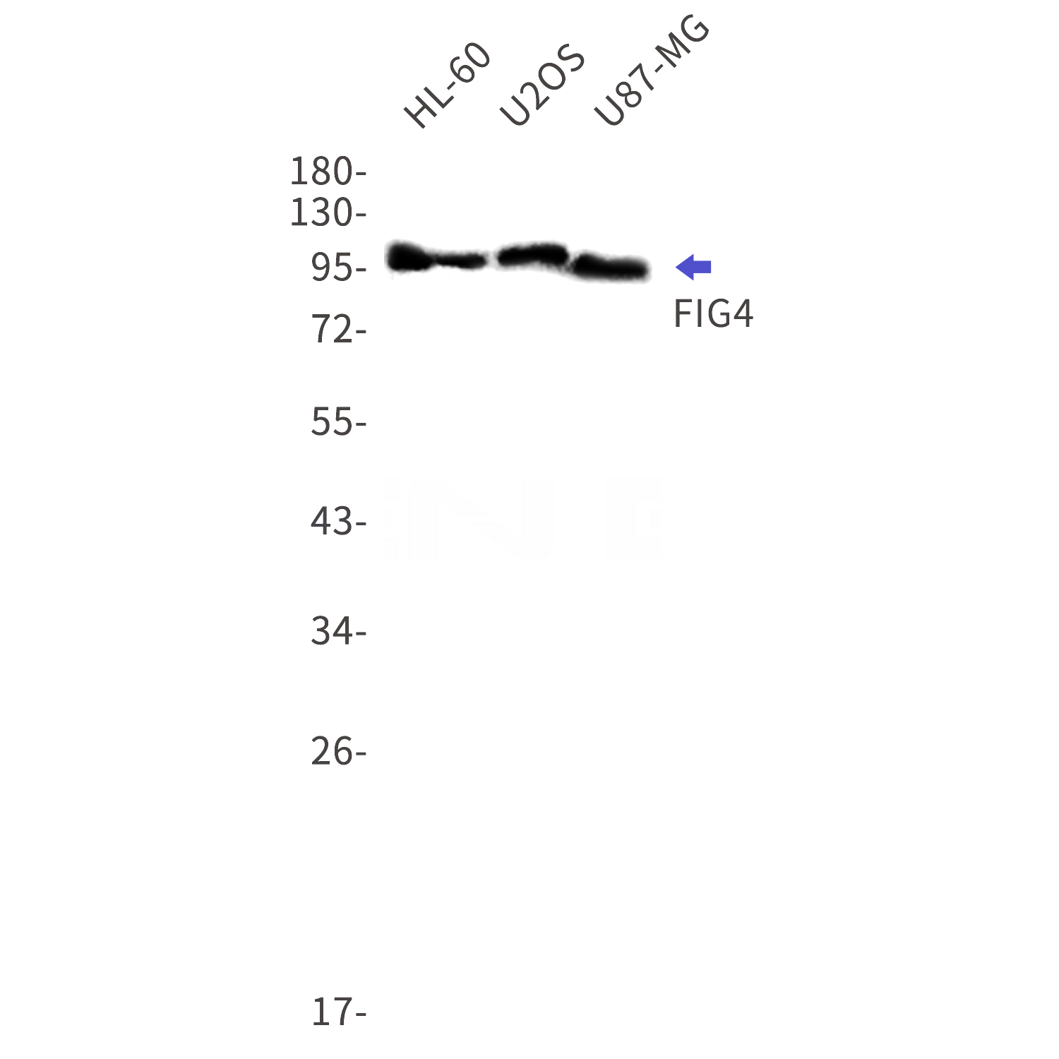 Western blot detection of FIG4 in HL-60,U2OS,U87-MG cell lysates using FIG4 Rabbit mAb(1:1000 diluted).Predicted band size:104kDa.Observed band size:104kDa.