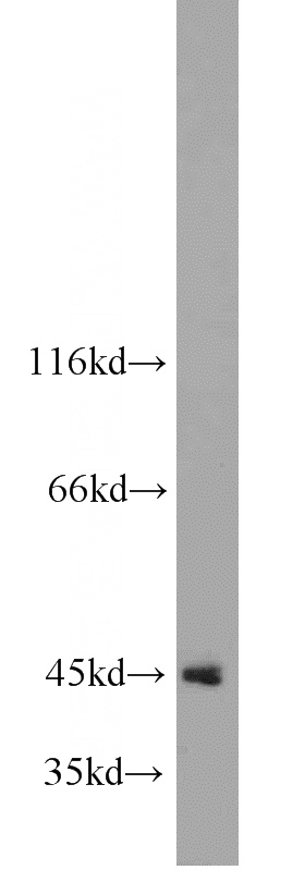 HeLa cells were subjected to SDS PAGE followed by western blot with Catalog No:113763(PDCD2 antibody) at dilution of 1:800