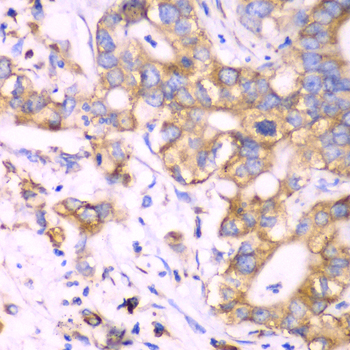 Immunohistochemistry - RPS3A Polyclonal Antibody 