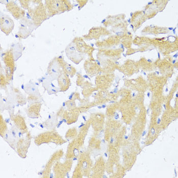 Immunohistochemistry - NAT2 Polyclonal Antibody 