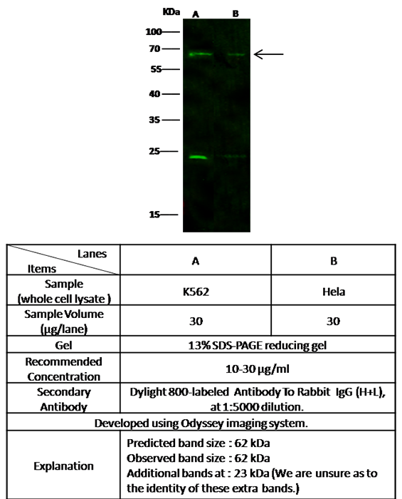 GNL3 / Nucleostemin Antibody, Rabbit PAb, Antigen Affinity Purified, Western blot