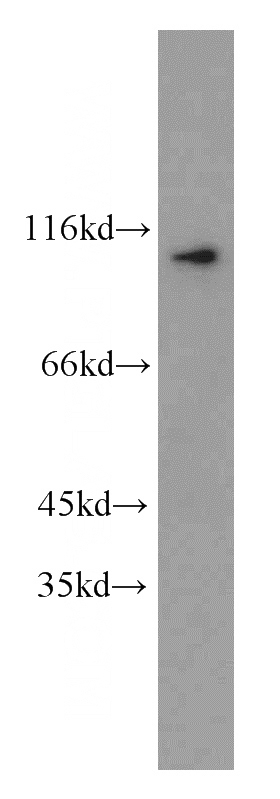 CHO cells were subjected to SDS PAGE followed by western blot with Catalog No:110340(RAPGEF3 antibody) at dilution of 1:1000