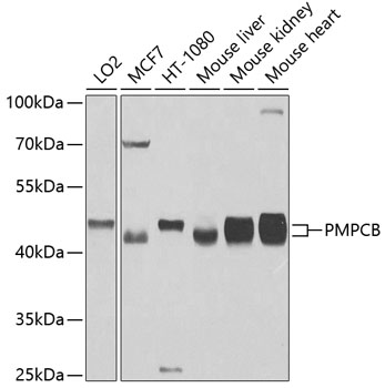 Western blot - PMPCB Polyclonal Antibody 