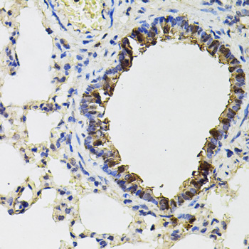 Immunohistochemistry - ACO1 Polyclonal Antibody 