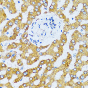Immunohistochemistry - CCL25 Polyclonal Antibody 